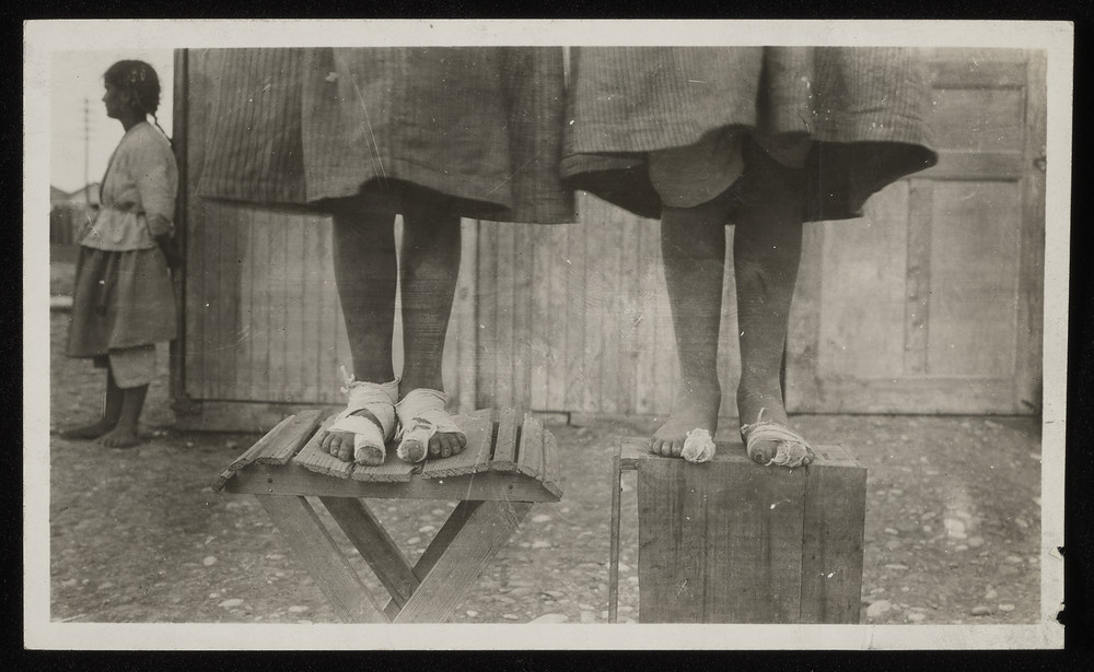 Girls receive medical care for foot injuries after traveling on foot to a Near East Relief orphanage. Many children arrived with severe sunburn and frostbite, having nothing but scavenged rags to protect them from the elements.